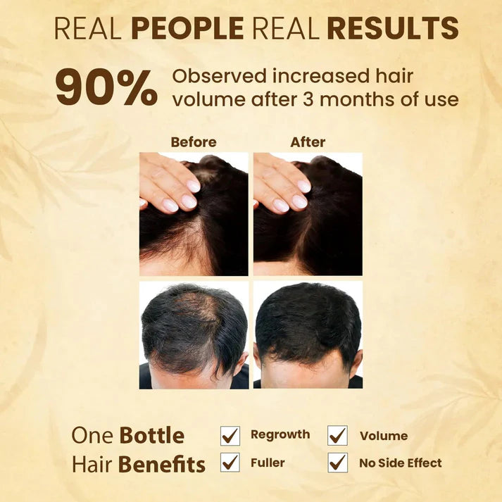 Jamalgota Ayurvedic Hair Growth Powder